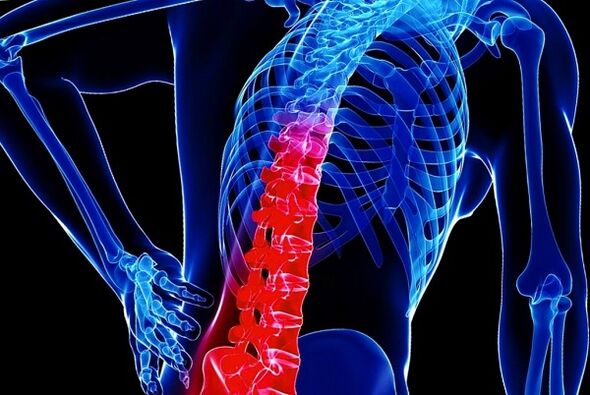 Osteokonondrosi torakoa garatzeko arrazoiak