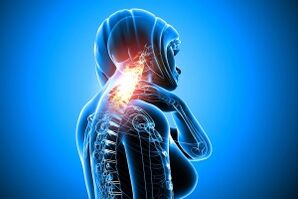 Osteokondrosia bizkarrezurraren bizkarrezurrean